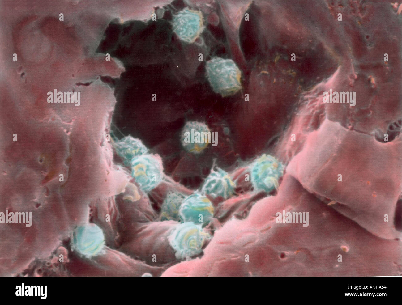 Le cellule bianche del sangue linfociti nella vena umana un linfocita è un globulo bianco che è formata nel tessuto linfoide una venula è Foto Stock