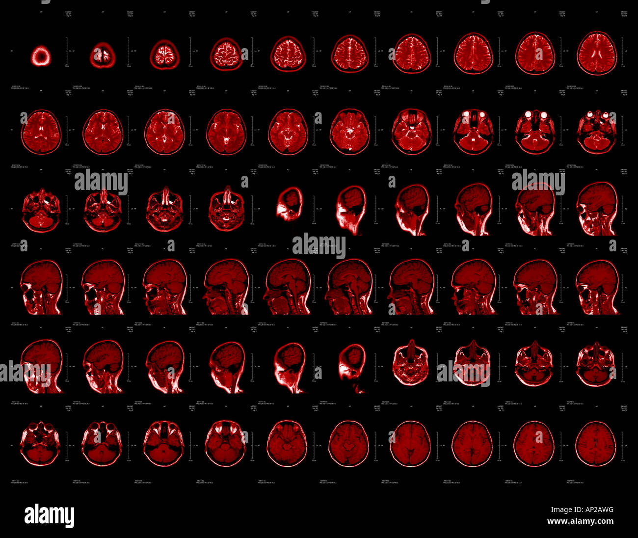 Testa MRI Foto Stock
