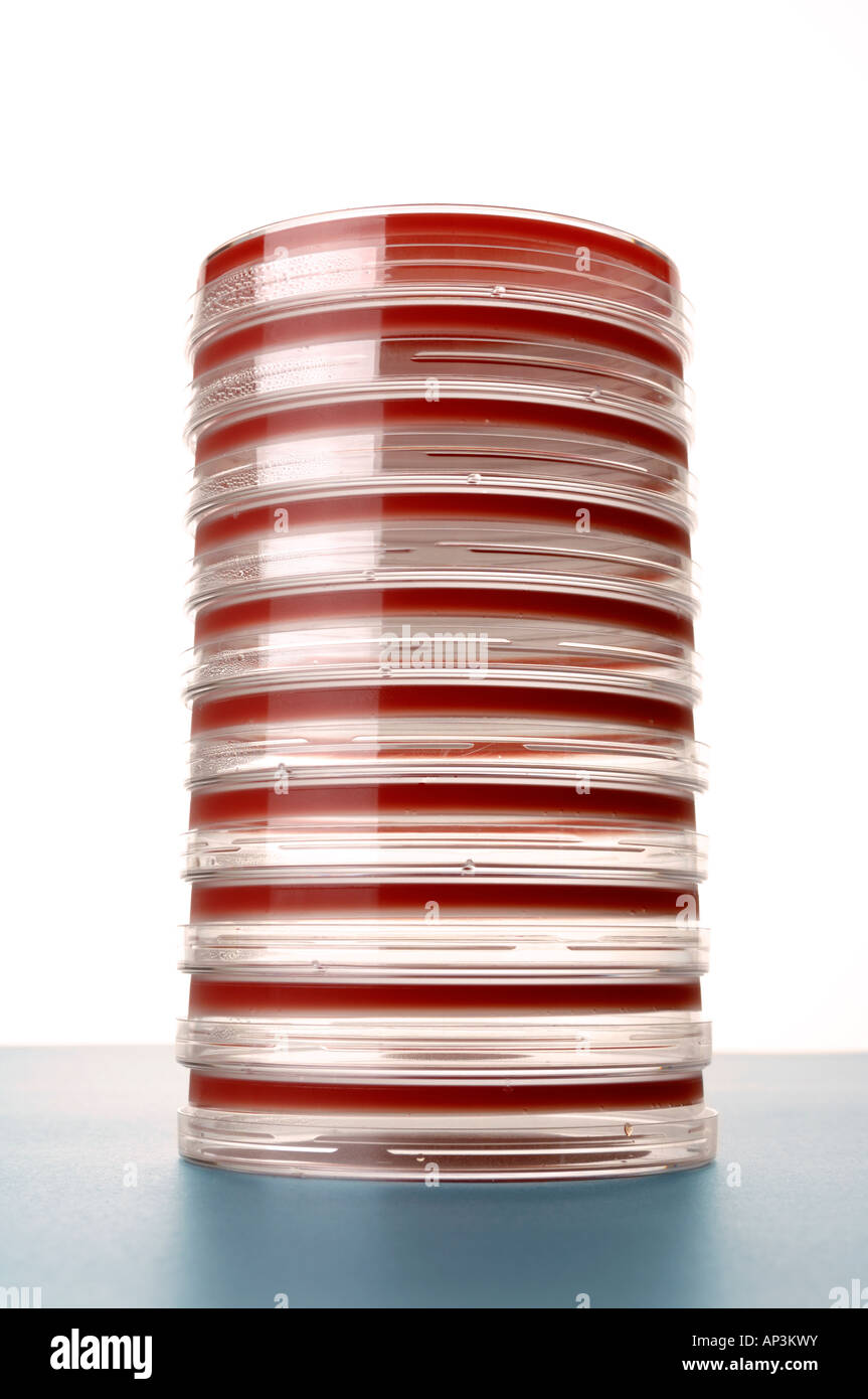Capsule Petri con agar di sangue Foto Stock