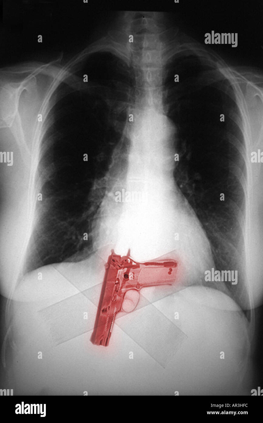 Simulazione di controlli di sicurezza in aeroporto a raggi X che mostra un celato Smith and Wesson 9mm pistola nastrato per una persona della vita Foto Stock