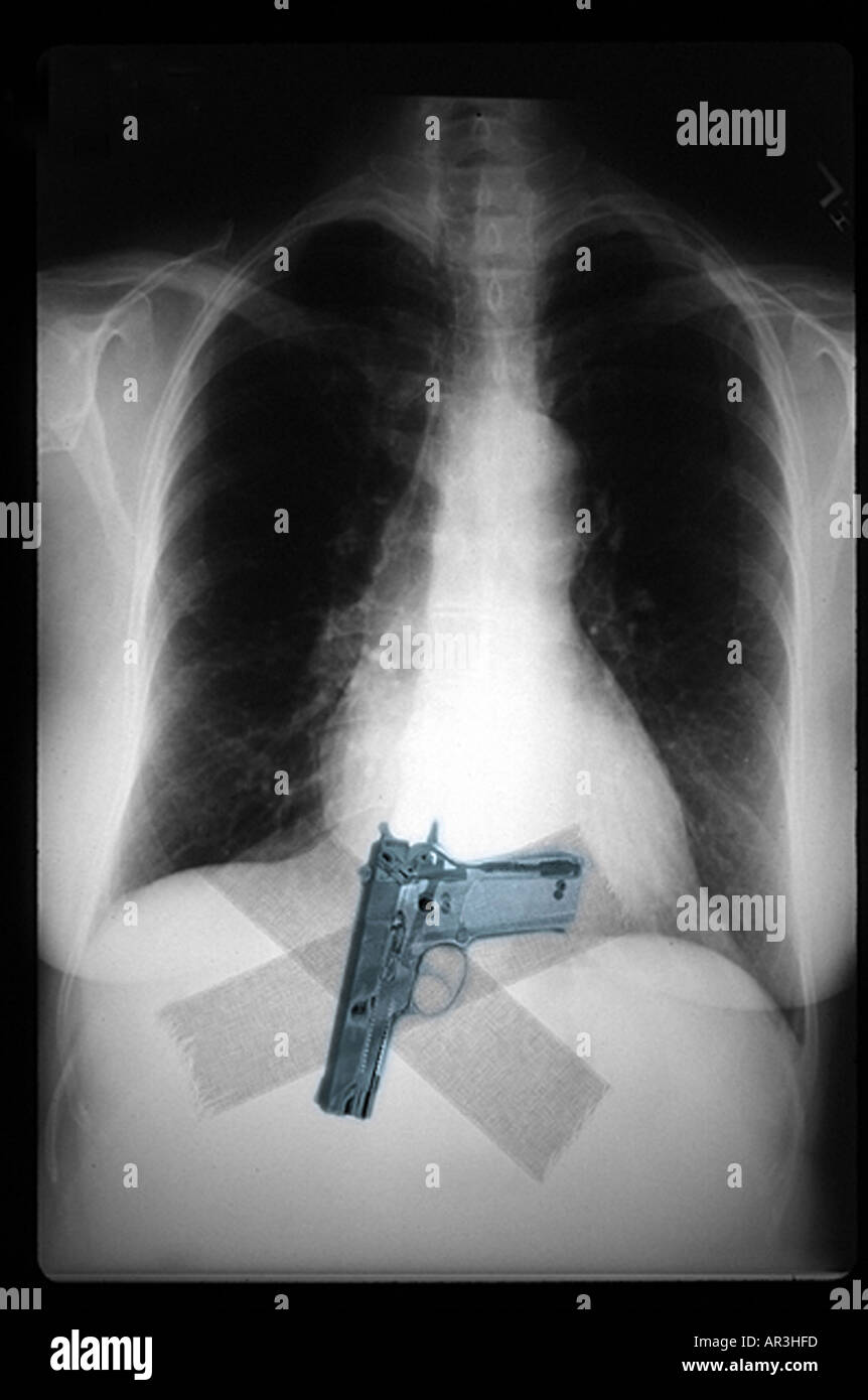 Simulazione di controlli di sicurezza in aeroporto a raggi X che mostra un celato Smith and Wesson 9mm pistola nastrato per una persona della vita Foto Stock