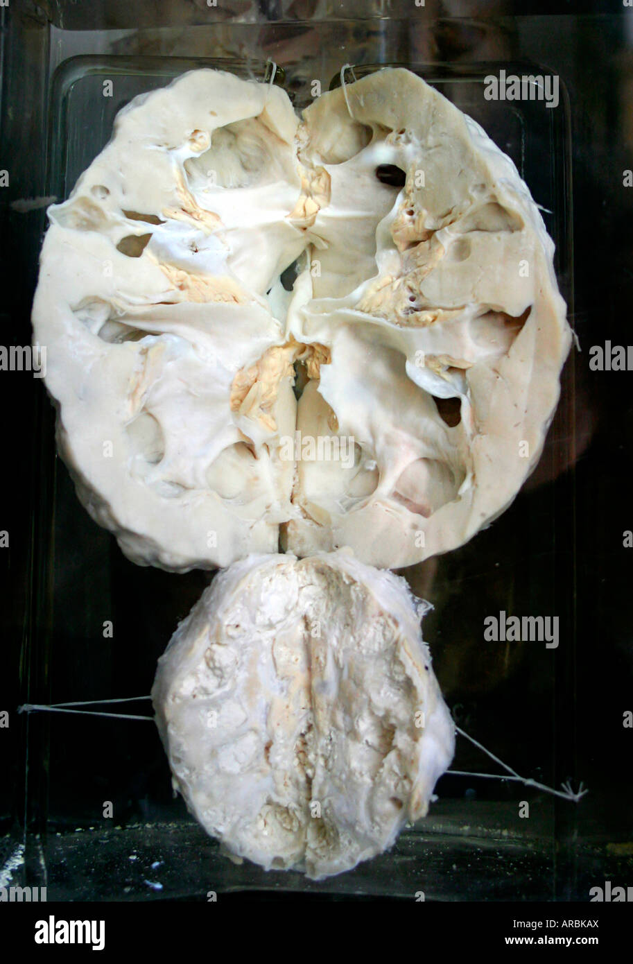 rene; sezione Foto Stock