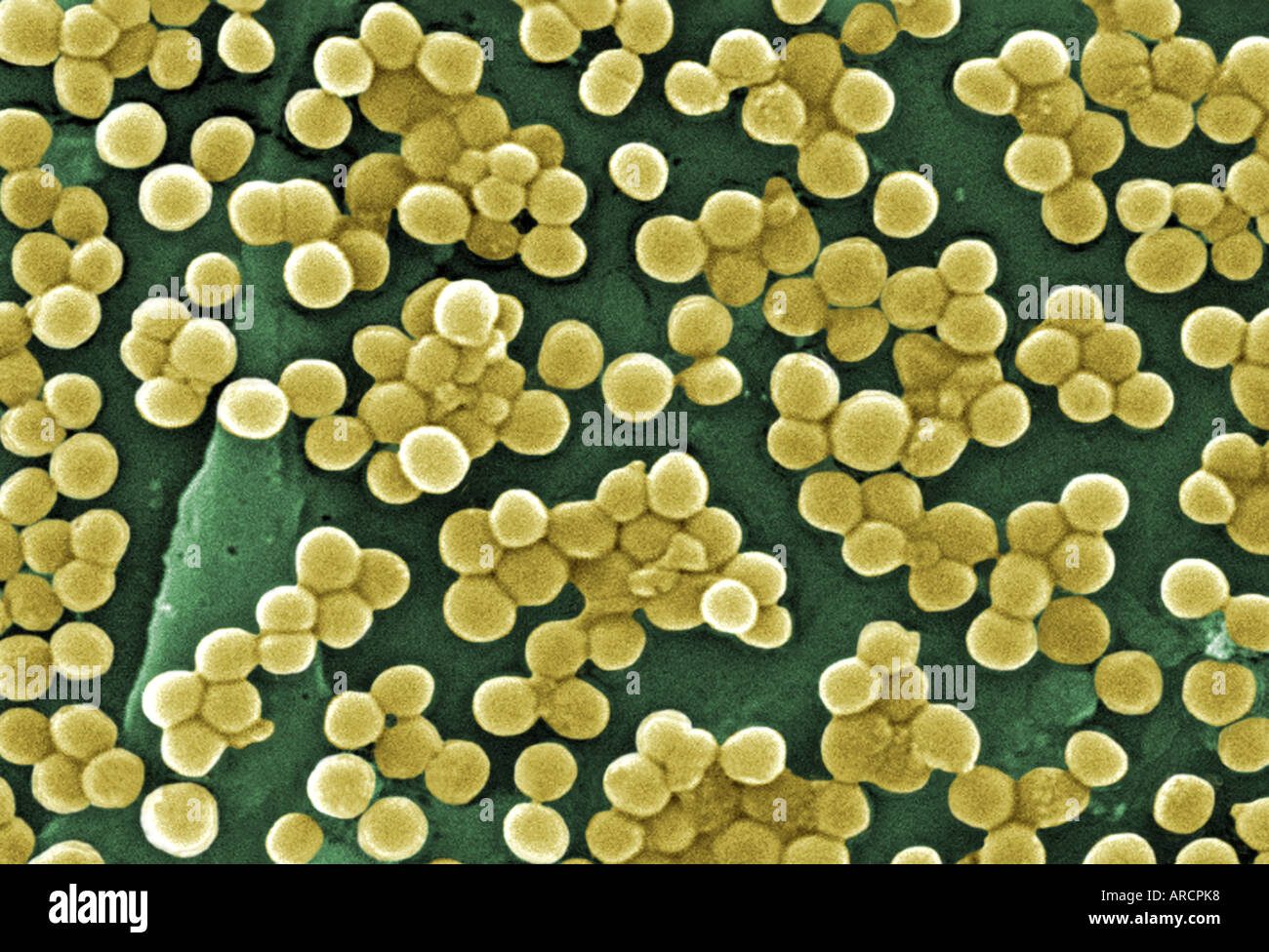 Questo scanning electron microfotografia (SEM) mostra numerosi grumi di Staphylococcus aureus resistente alla meticillina batteri Foto Stock