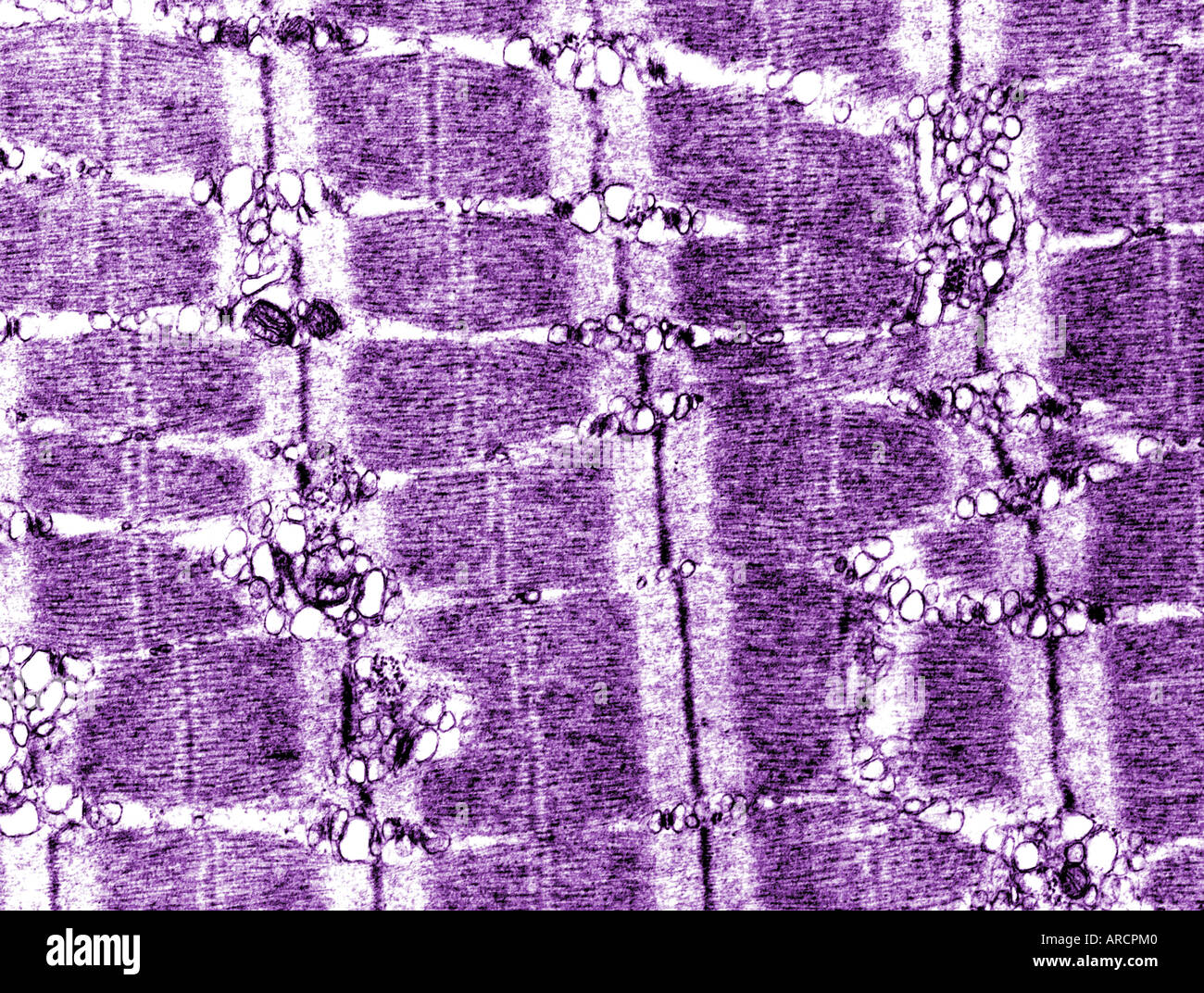 Una micrografia elettronica a trasmissione (TEM) striati di muscolo scheletrico in sezione longitudinale. Foto Stock