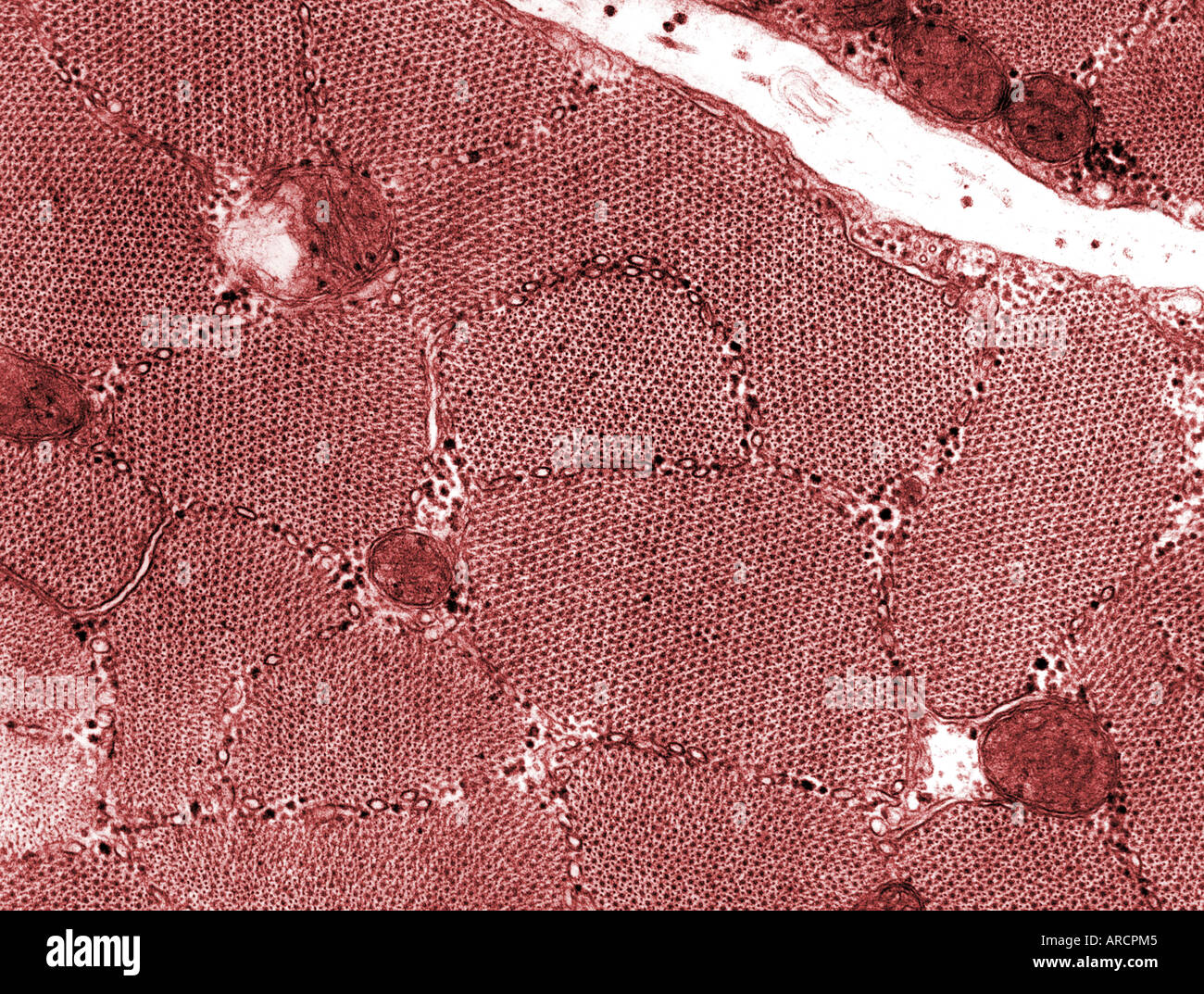 Una micrografia elettronica a trasmissione (TEM) del muscolo scheletrico in sezione trasversale. Foto Stock