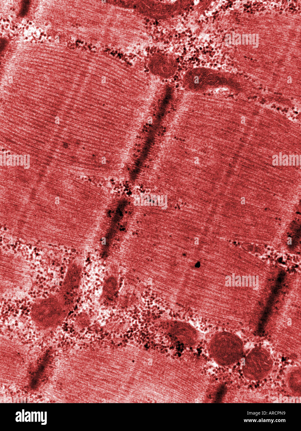Una micrografia elettronica a trasmissione (TEM) di myofibrils in fibra di muscolo scheletrico, Foto Stock
