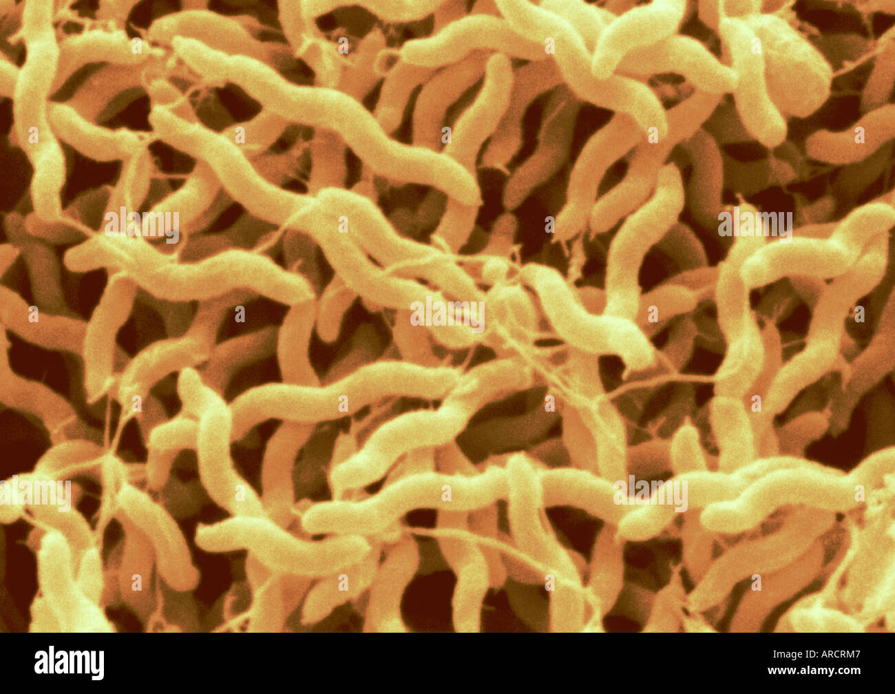 Questo è un colore enhanced scanning electron microfotografia del batterio Campylobacter jejuni. Foto Stock