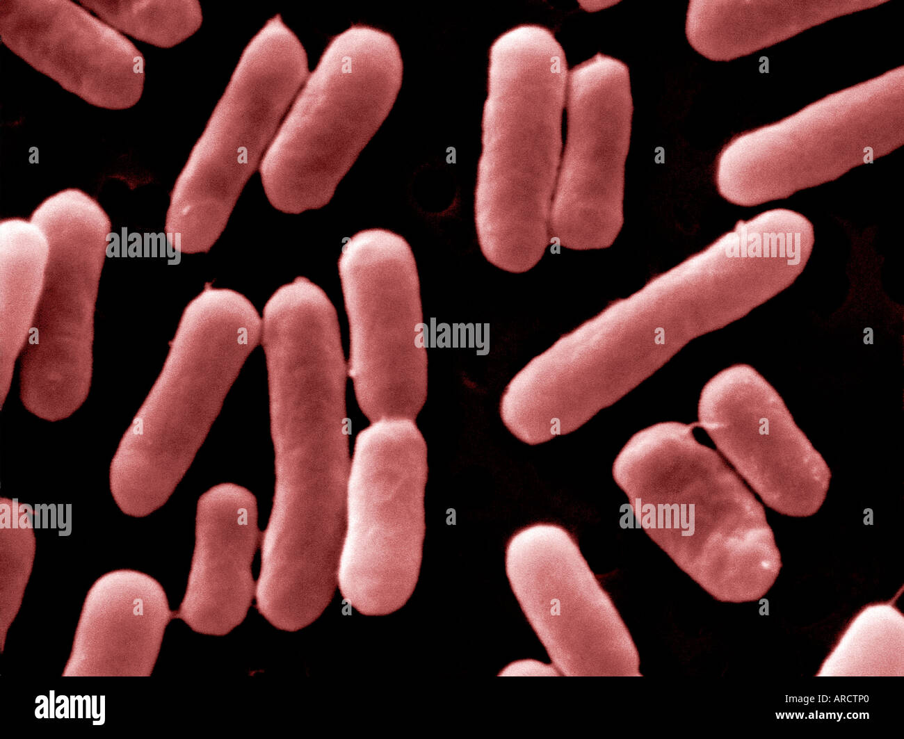 Una micrografia elettronica a scansione della Salmonella typhimurium DT 104. Foto Stock