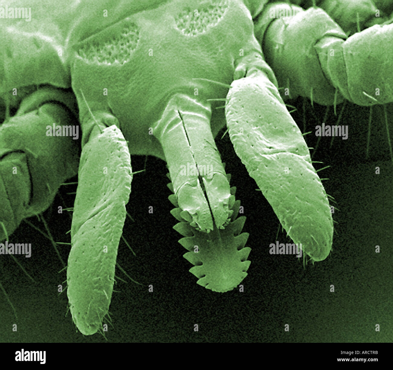 Una micrografia al microscopio elettronico a scansione (SEM) del cervo tick (Ixodes dammini), ingrandite x100. Questo è il vettore della malattia di Lyme. Foto Stock