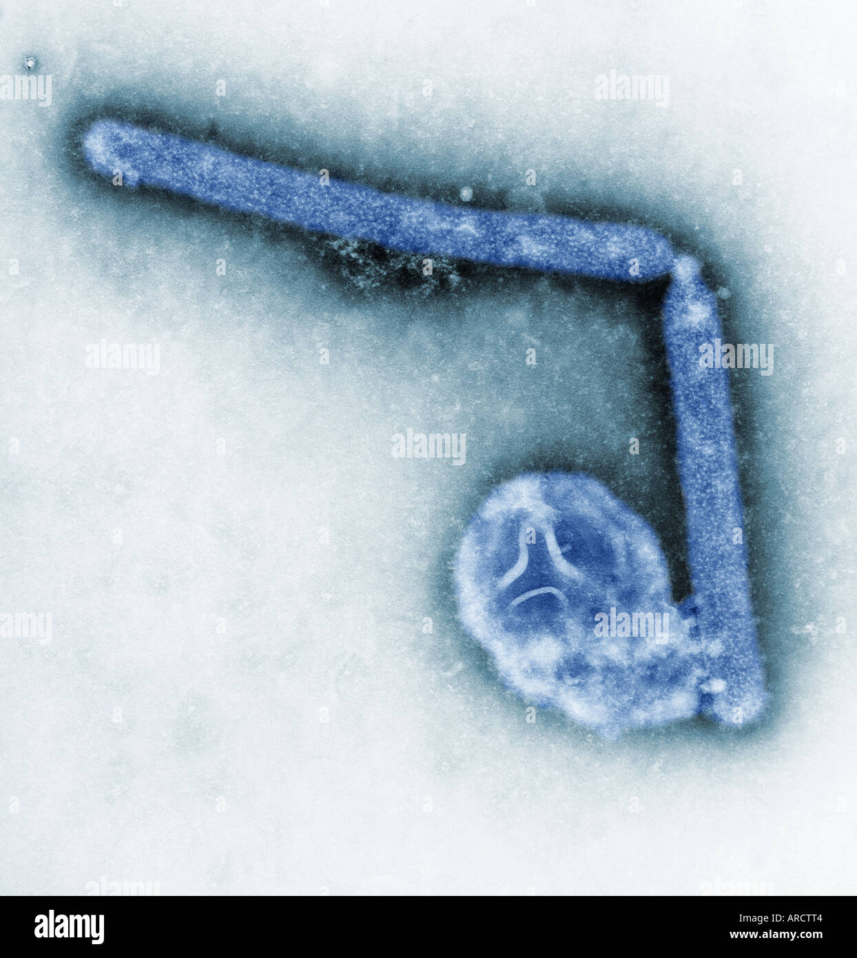 Microscopio elettronico a trasmissione (TEM), l'ingrandimento di 108,000x, rivela i dettagli ultrastrutturali dei due influenza aviaria Foto Stock