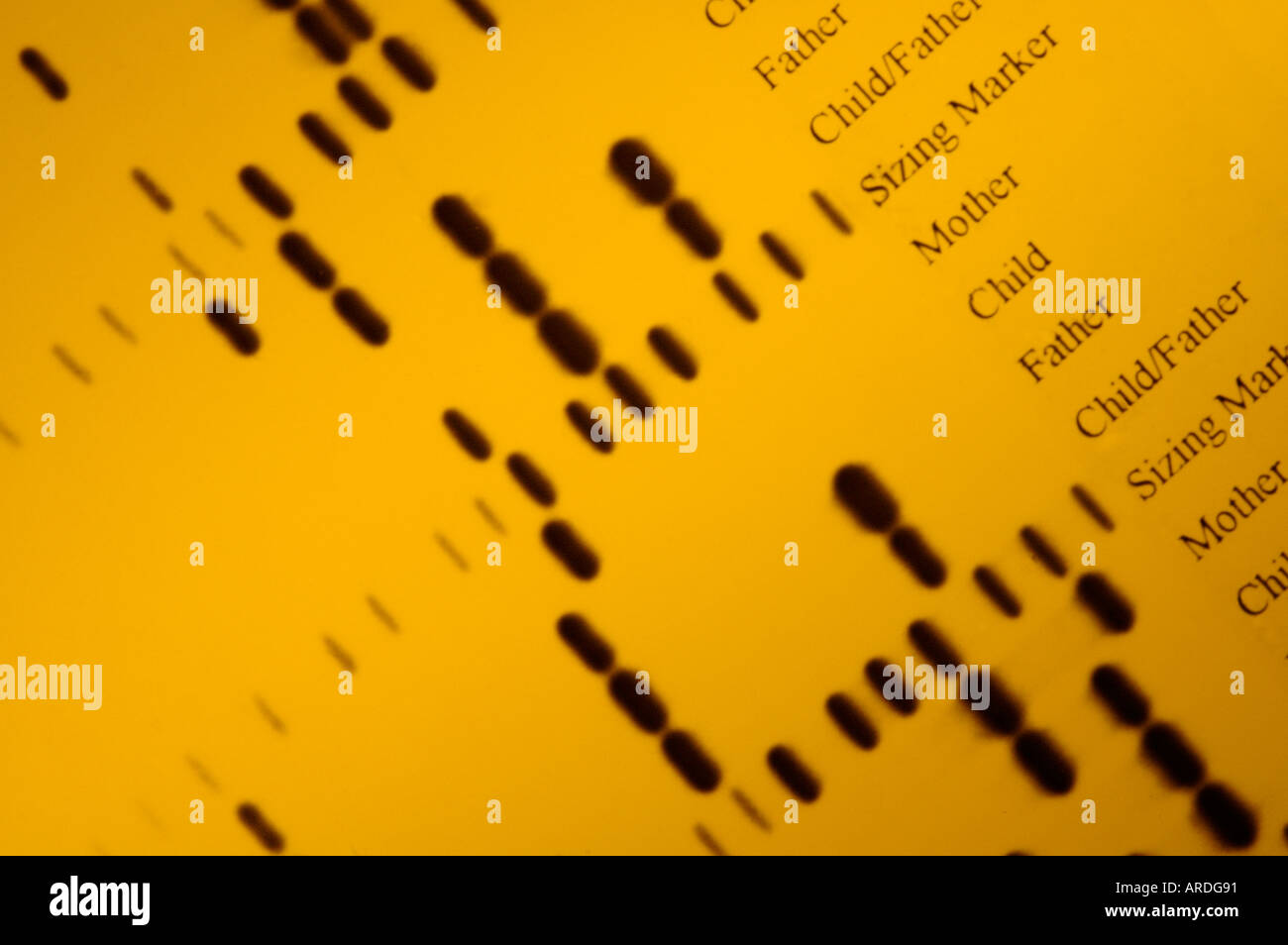 Autoradiografia del 'DNA impronte digitali' dalla determinazione di paternità indagini Foto Stock