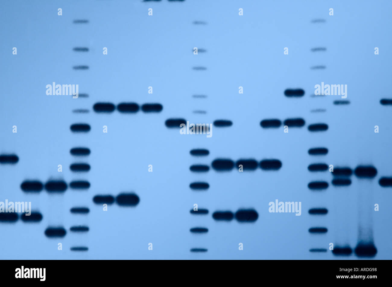 Autoradiografia 'DNA impronte digitali" di una varietà di campioni di DNA. Foto Stock