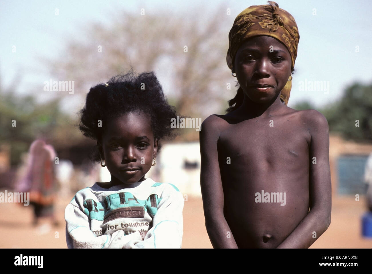 Bambini africani magri immagini e fotografie stock ad alta risoluzione -  Alamy