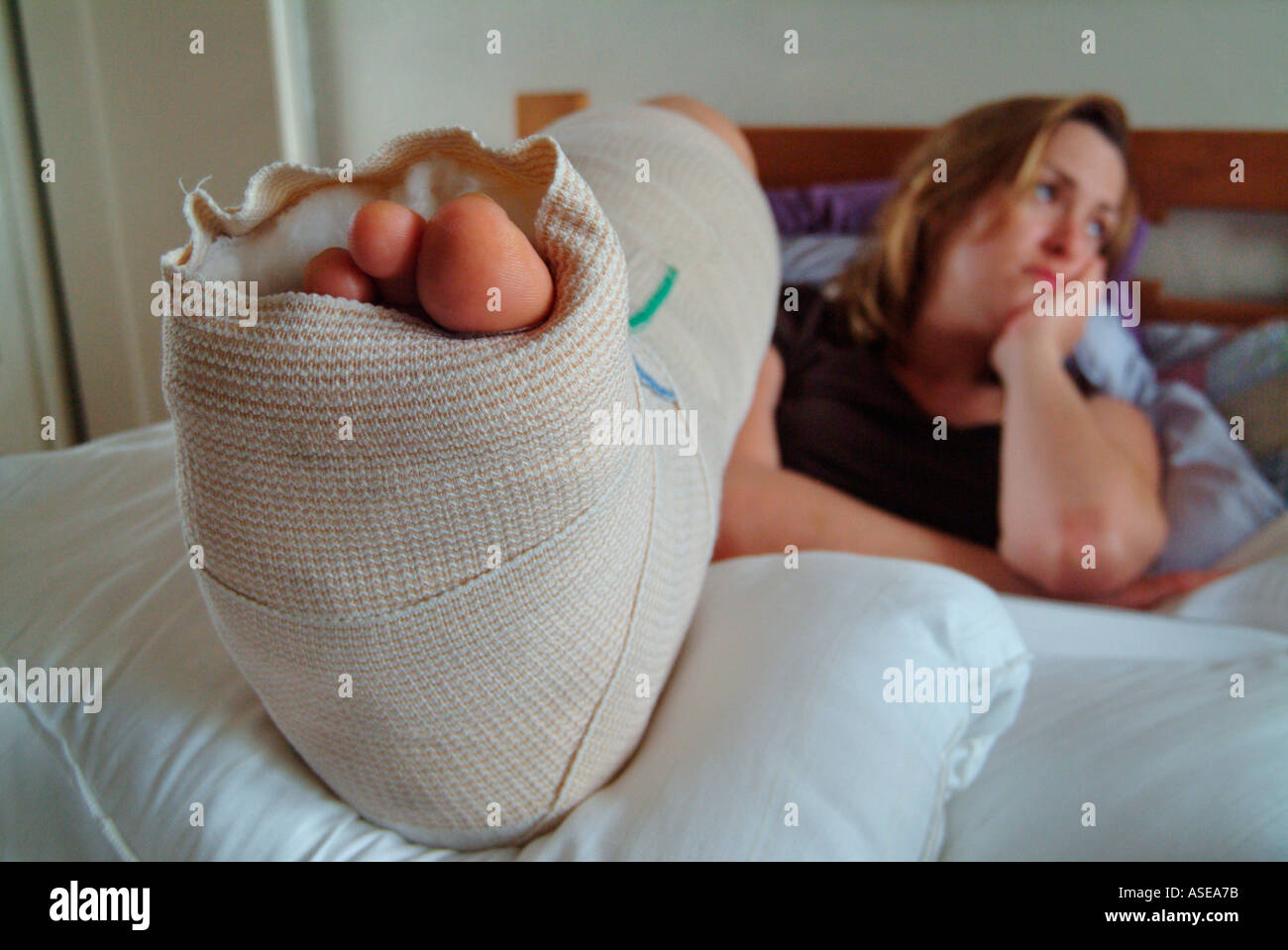 Donna con un cast sul suo appoggia gambe nel letto a causa di un piede del pregiudizio Foto Stock