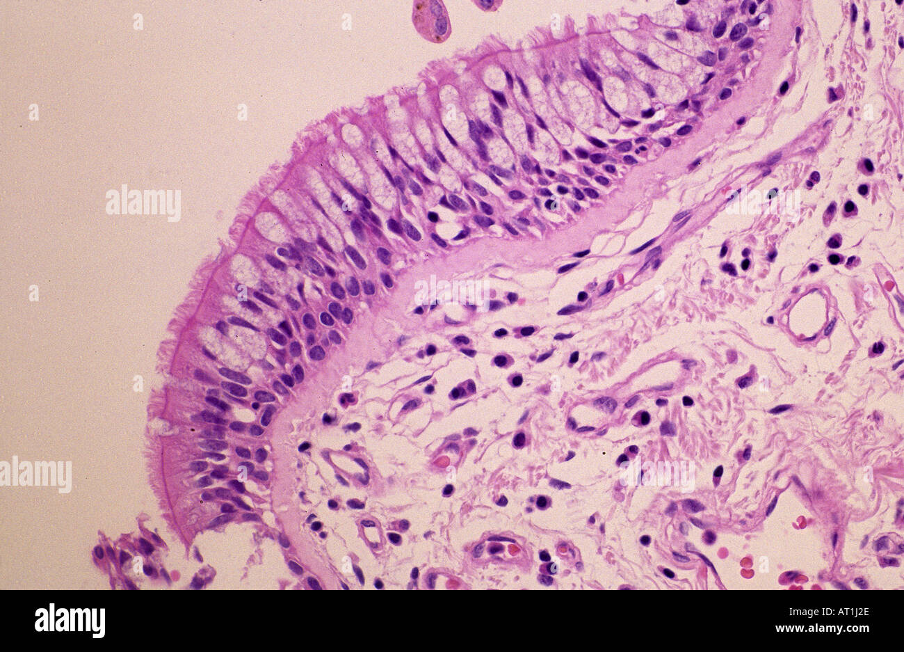 Il tessuto epiteliale della trachea epitelio tracheale Foto stock - Alamy