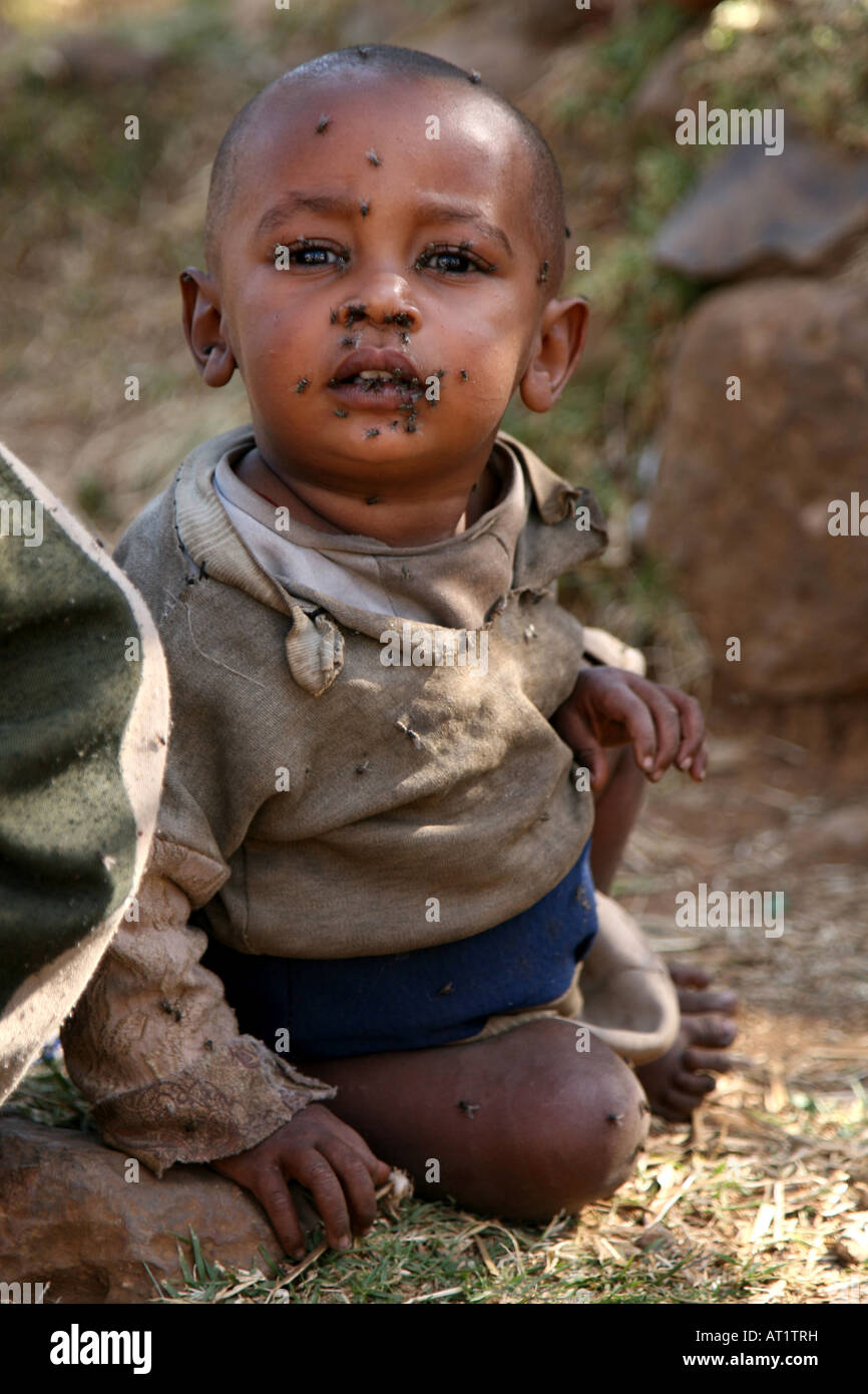 Giovane ragazzo africano con vola sul suo volto in Etiopia Foto Stock