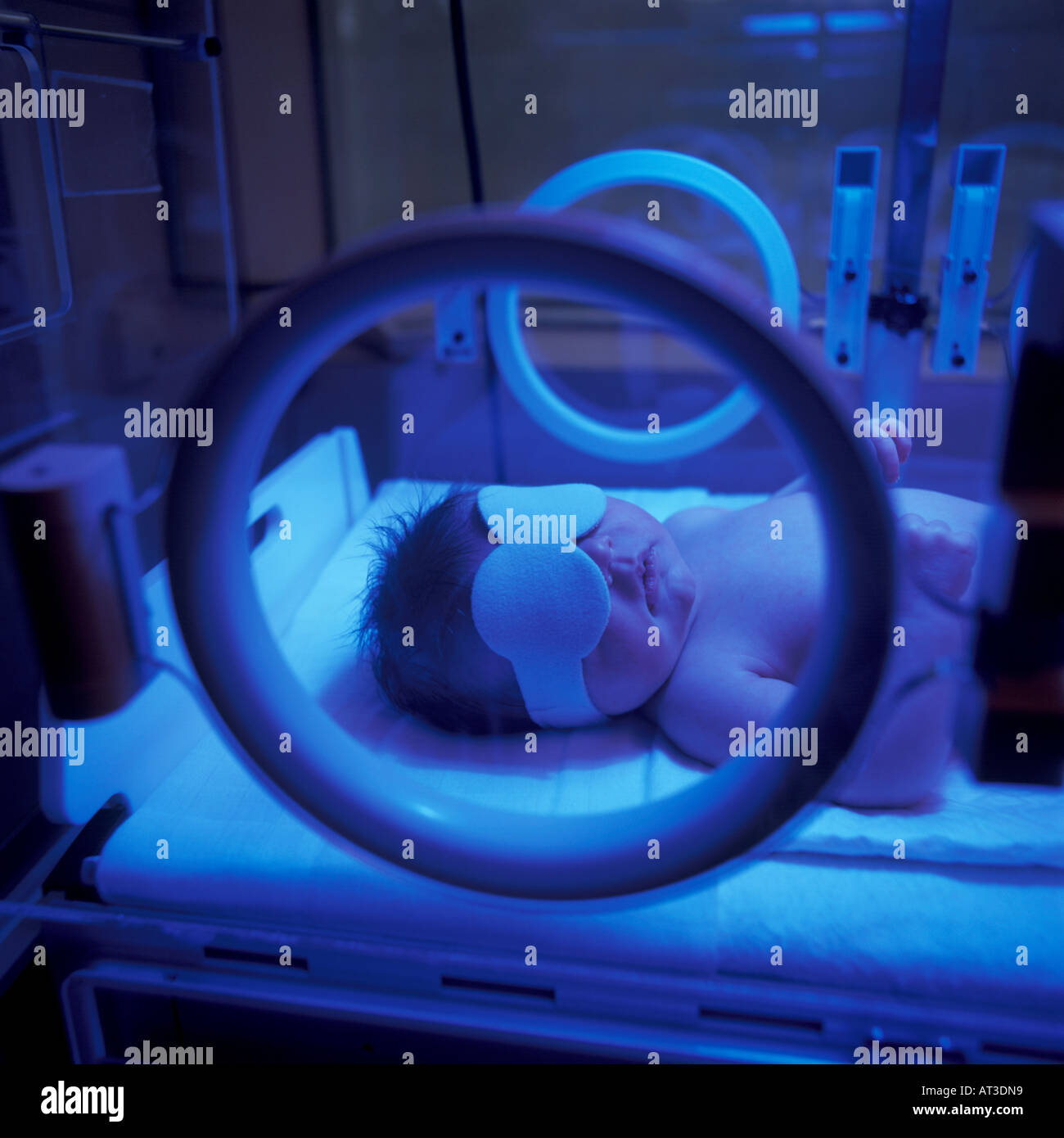 Bambino prematuro in incubatrice con luce ultra violetta Foto Stock