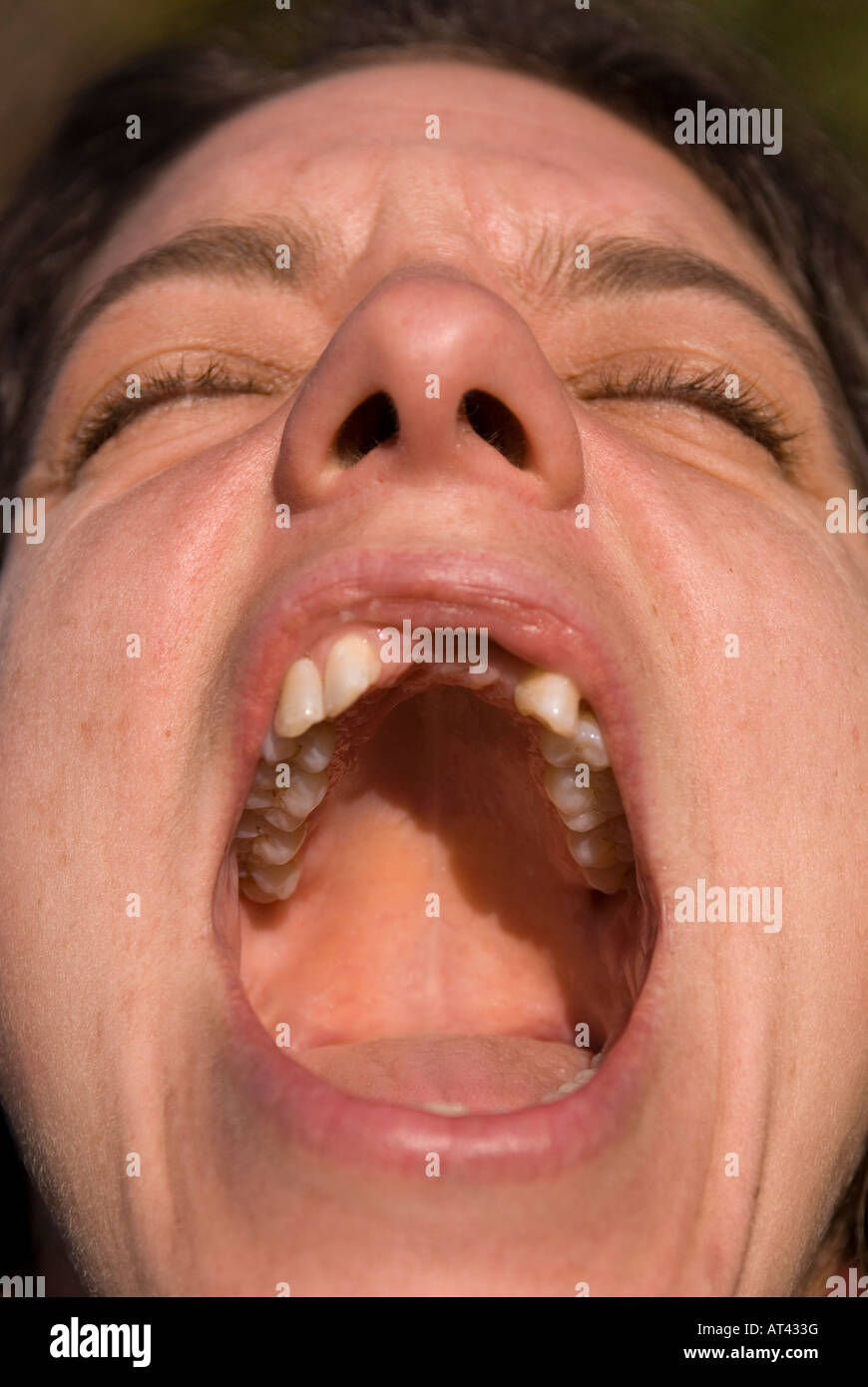Donna con mancano denti frontali urlando Foto Stock