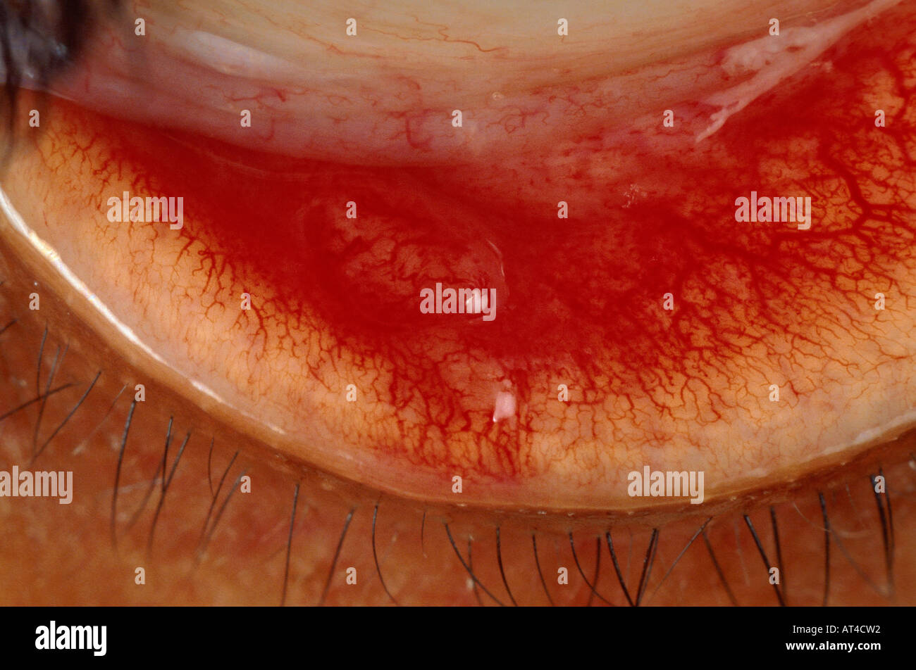 umano della palpebra Foto Stock