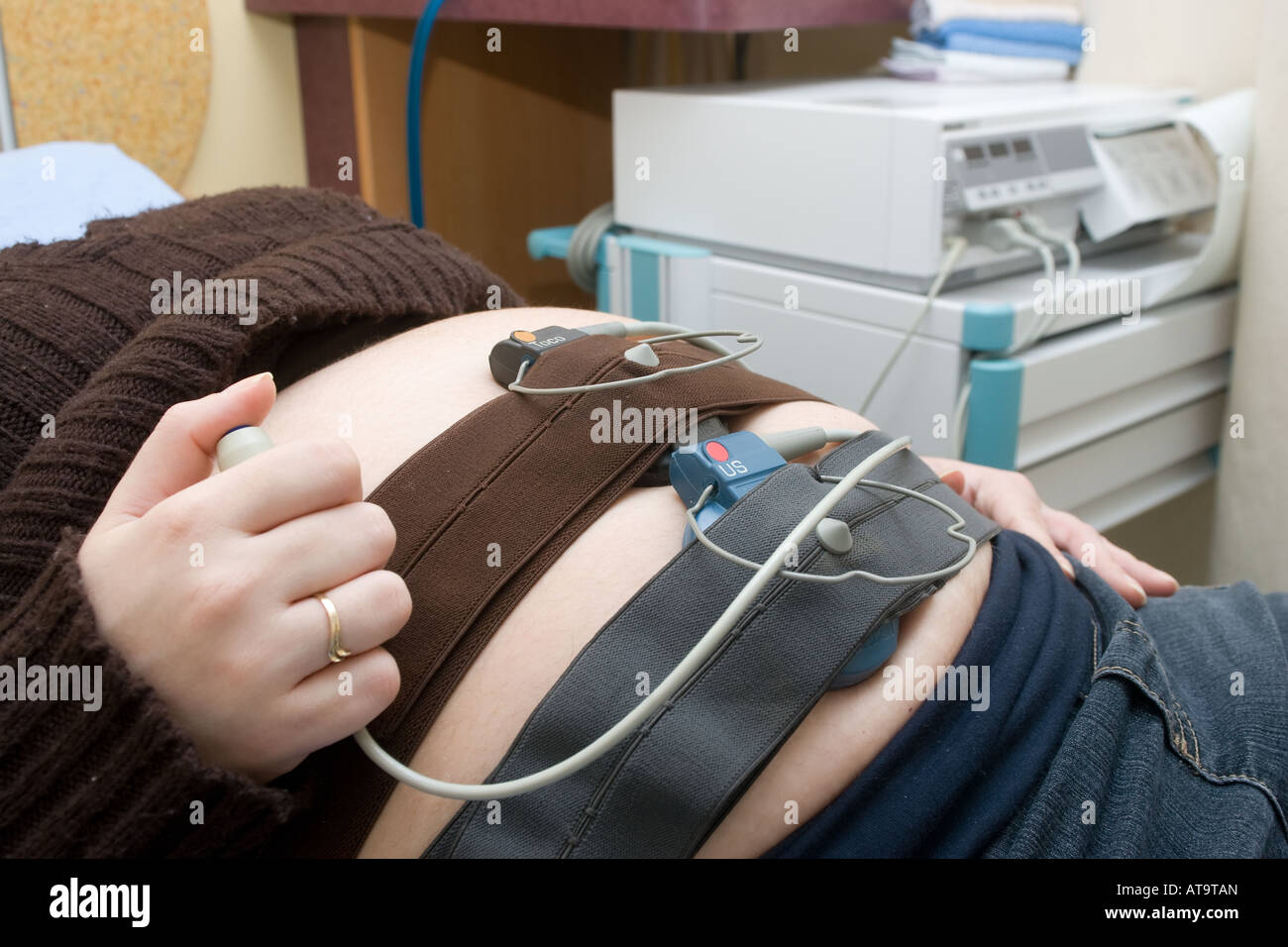 Un paziente riceve un nonstress test NST presso il Chul Hospital di Quebec City. NST è un Doppler tempo di registrazione di serie del cuore Foto Stock