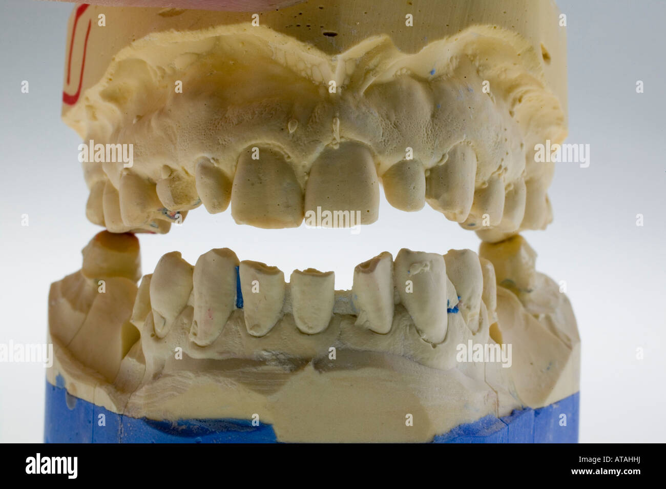 Modell für Zahnersatz, protesi dentarie Foto Stock