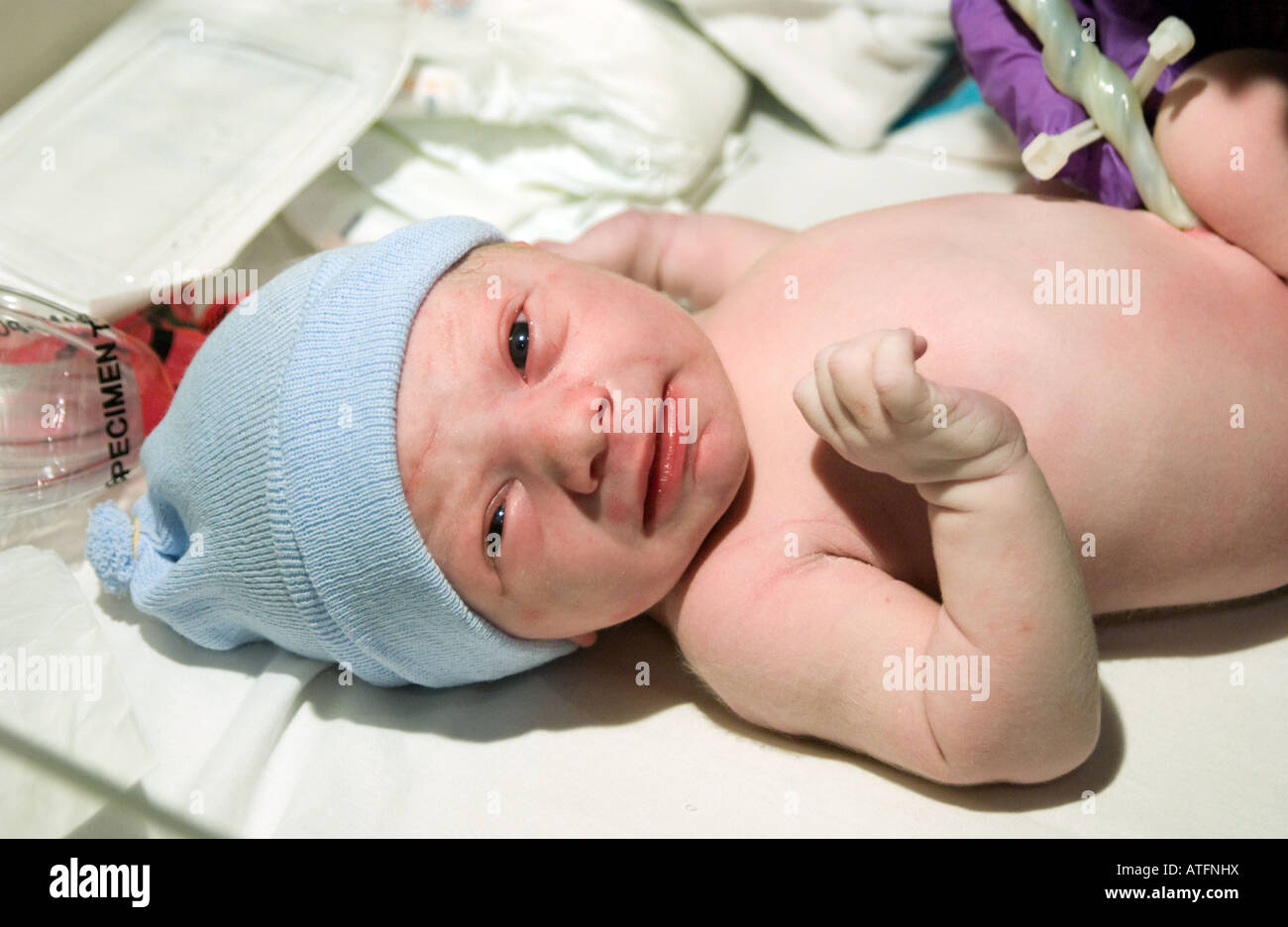 Un neonato ragazzo prende uno sguardo intorno a pochi minuti dopo essere nato con il cordone ombelicale ancora attaccato. Foto Stock