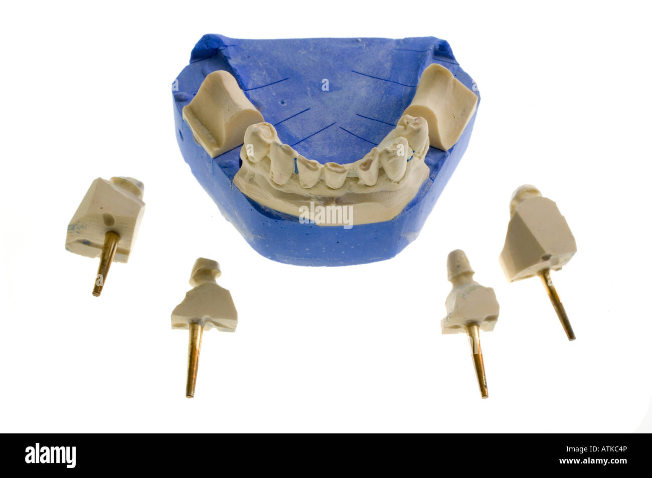 Modell für Zahnersatz protesi dentarie Foto Stock
