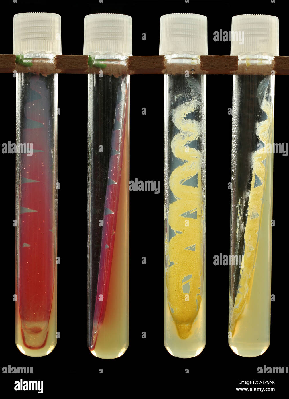 Agar tubo obliquo culture di Serratia marcescens (sinistra) e Kocuria rhizophila (Micrococcus luteus; a destra). Foto Stock