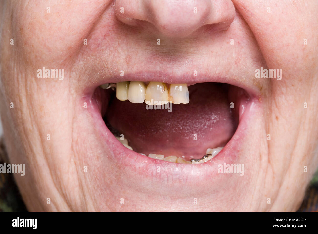 Chiudere-uo del volto di una donna anziana con denti mancanti Foto Stock