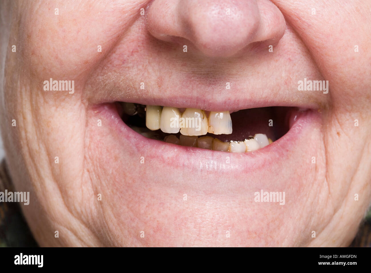 Chiudere-uo del volto di una donna anziana con denti mancanti Foto Stock