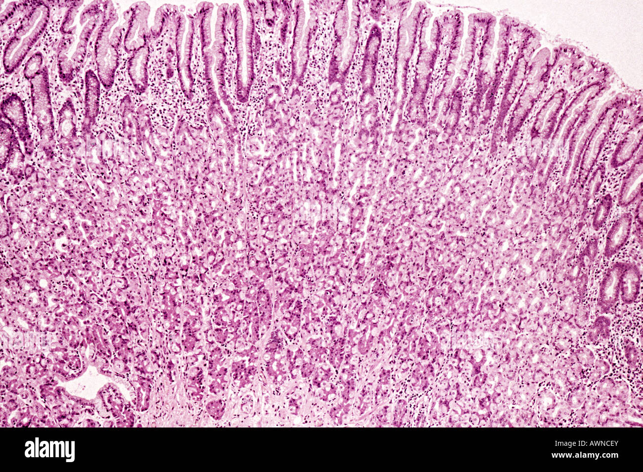 Mucosa dello stomaco Foto Stock