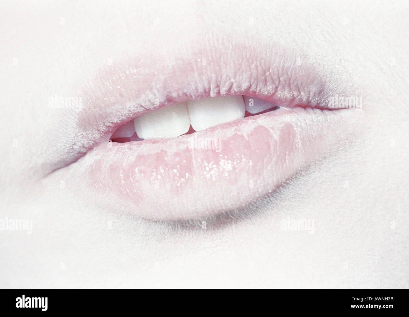 Бледные губы. Бледные губы это. Белая помада для губ. Бледные белые губы. Бледные губы это.