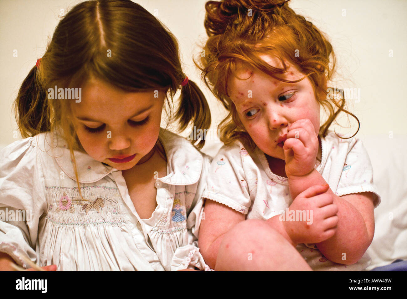 Bambina di tre anni con la varicella ascoltando la sua sorella di leggere una storia prima di addormentarsi Foto Stock