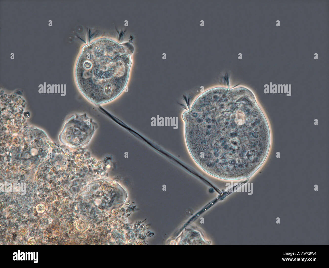 Vorticelle (vorticelle spec.), con contrasto di fase MRI Foto Stock