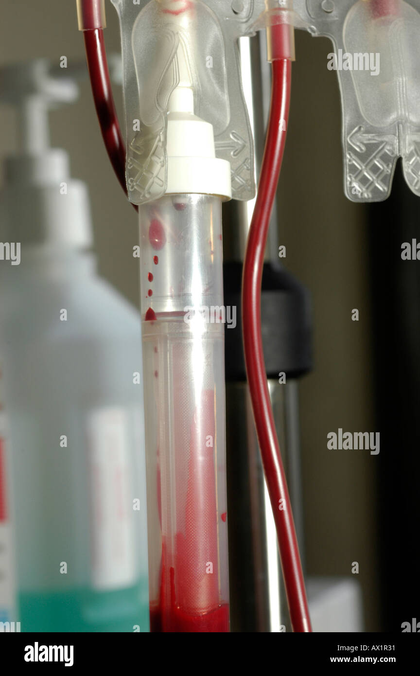 Per via endovenosa la camera di gocciolamento Foto Stock