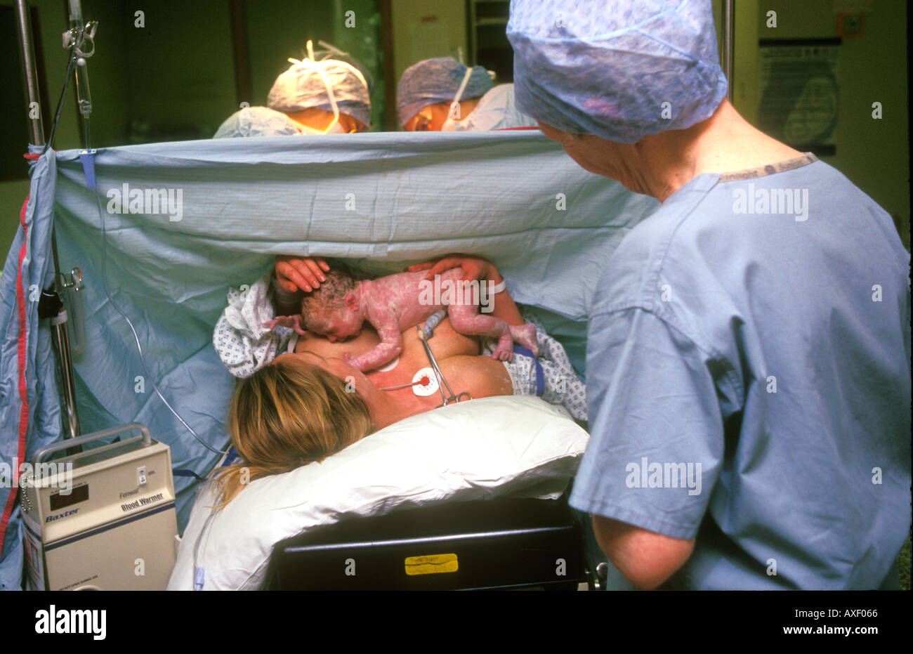 Neonato il legame con la madre dopo il taglio cesareo la nascita. Foto Stock