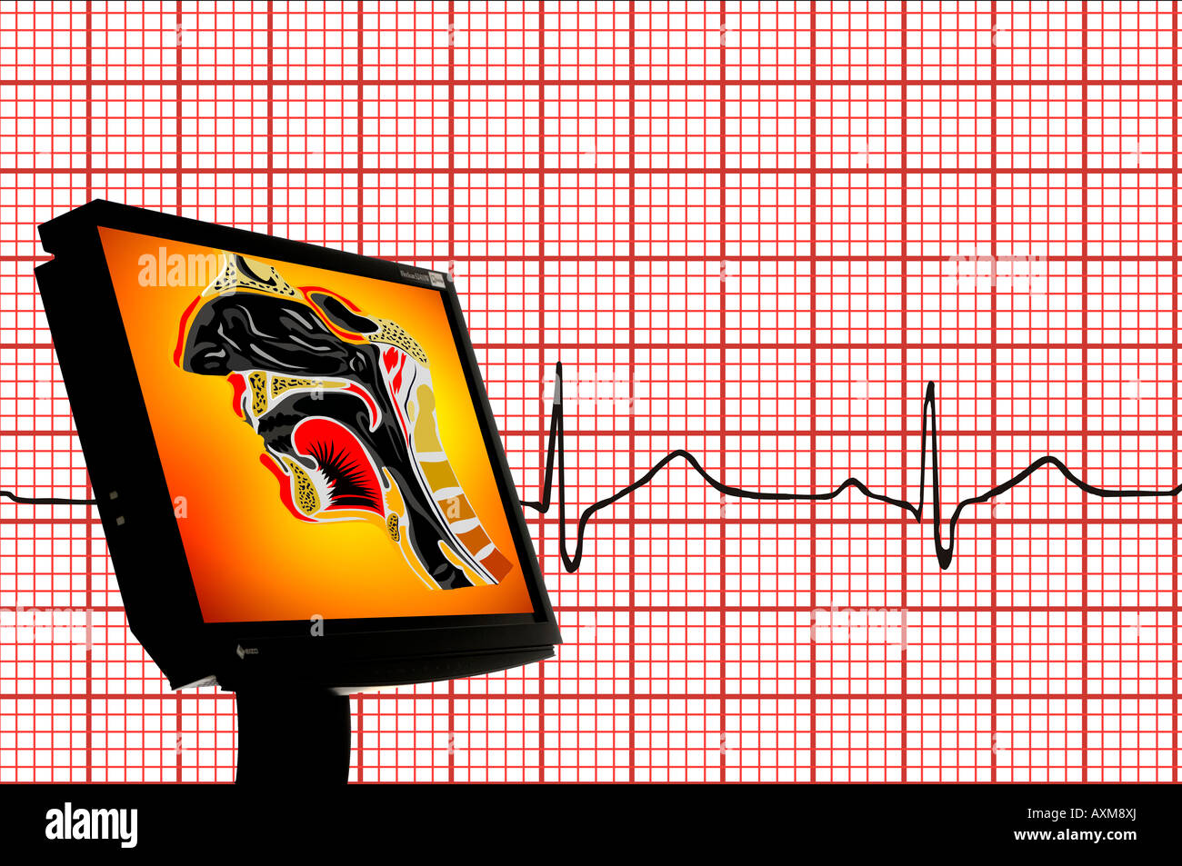 Generata da computer nasali umane immagine sul monitor con sfondo EKG Foto Stock