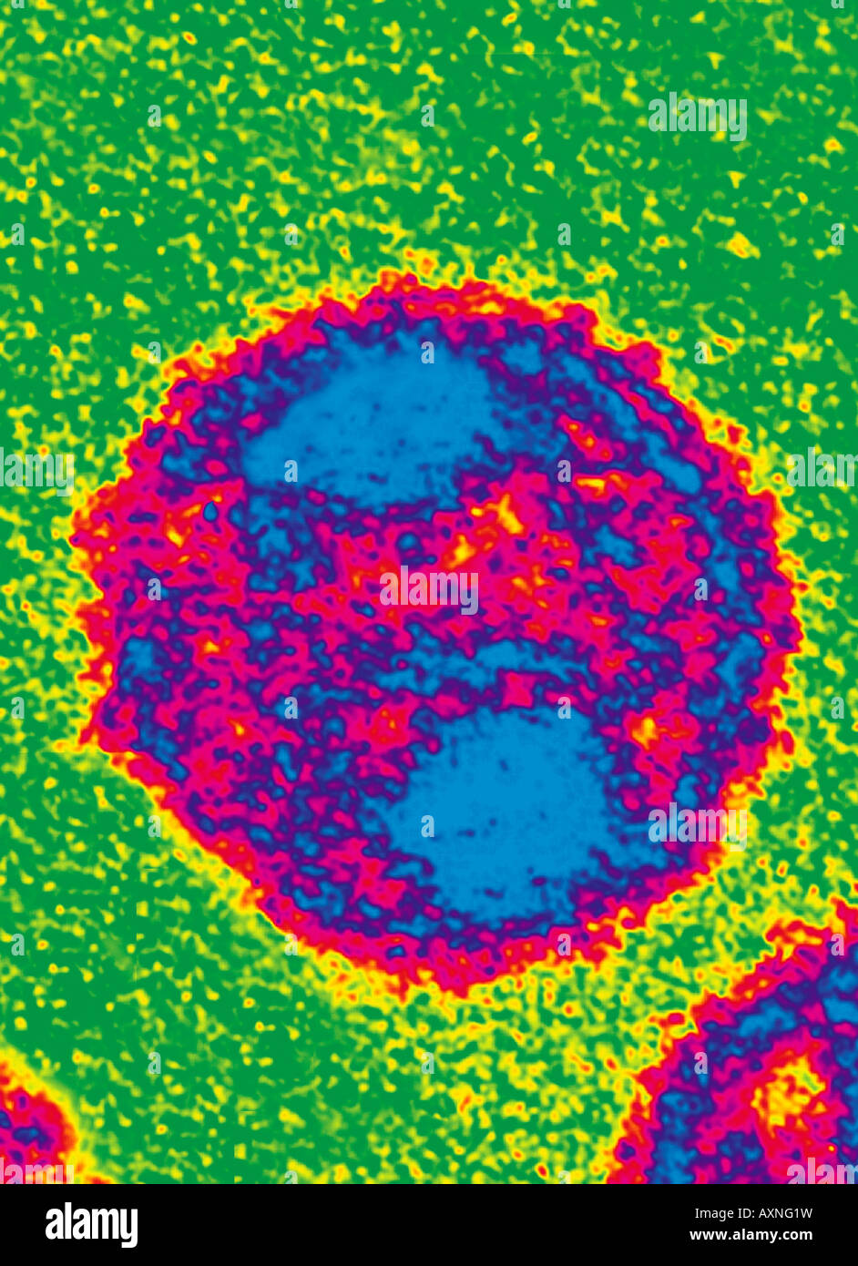Il virus HIV, virus dell'AIDS, come visto attraverso il microscopio EM Foto Stock