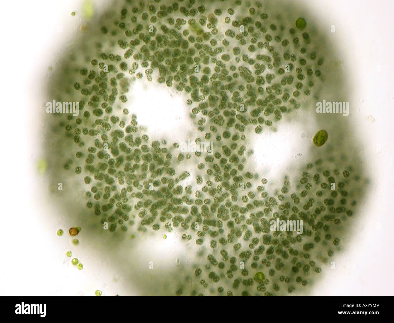 Microcystis flos-aquae (Microcystis flos-aquae), in shining-attraverso la luce Foto Stock
