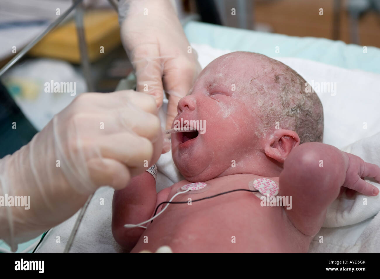 A 5 settimane bambino prematuro viene pulita della sua secrezione dal neonatality infermieri minuti dopo essere nato Foto Stock