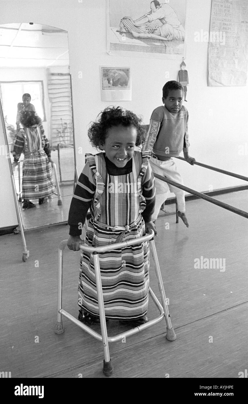 B/N di una giovane ragazza con un telaio e un ragazzo su barre parallele in un centro di riabilitazione per le vittime della polio. Asela, Shoa, Etiopia, Africa Foto Stock