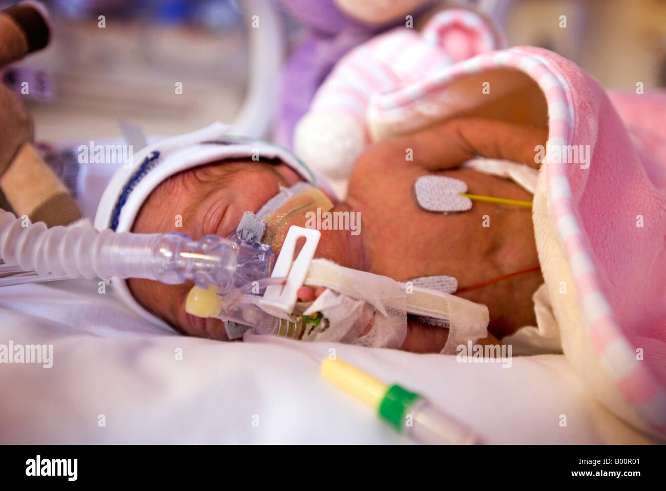 Prematura della unità di terapia intensiva neonatale (NICU) Foto Stock