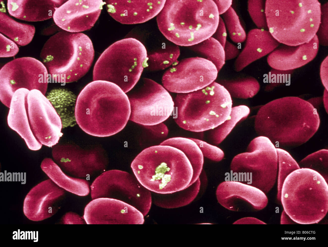 Le cellule rosse del sangue al microscopio elettronico a scansione Foto  stock - Alamy