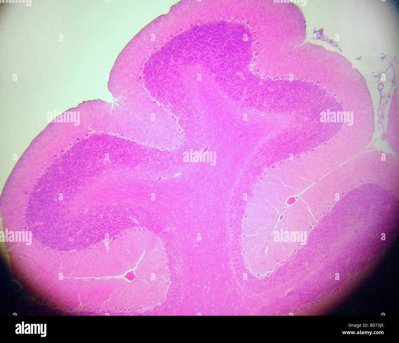 Il cervelletto LP FE253 Foto Stock