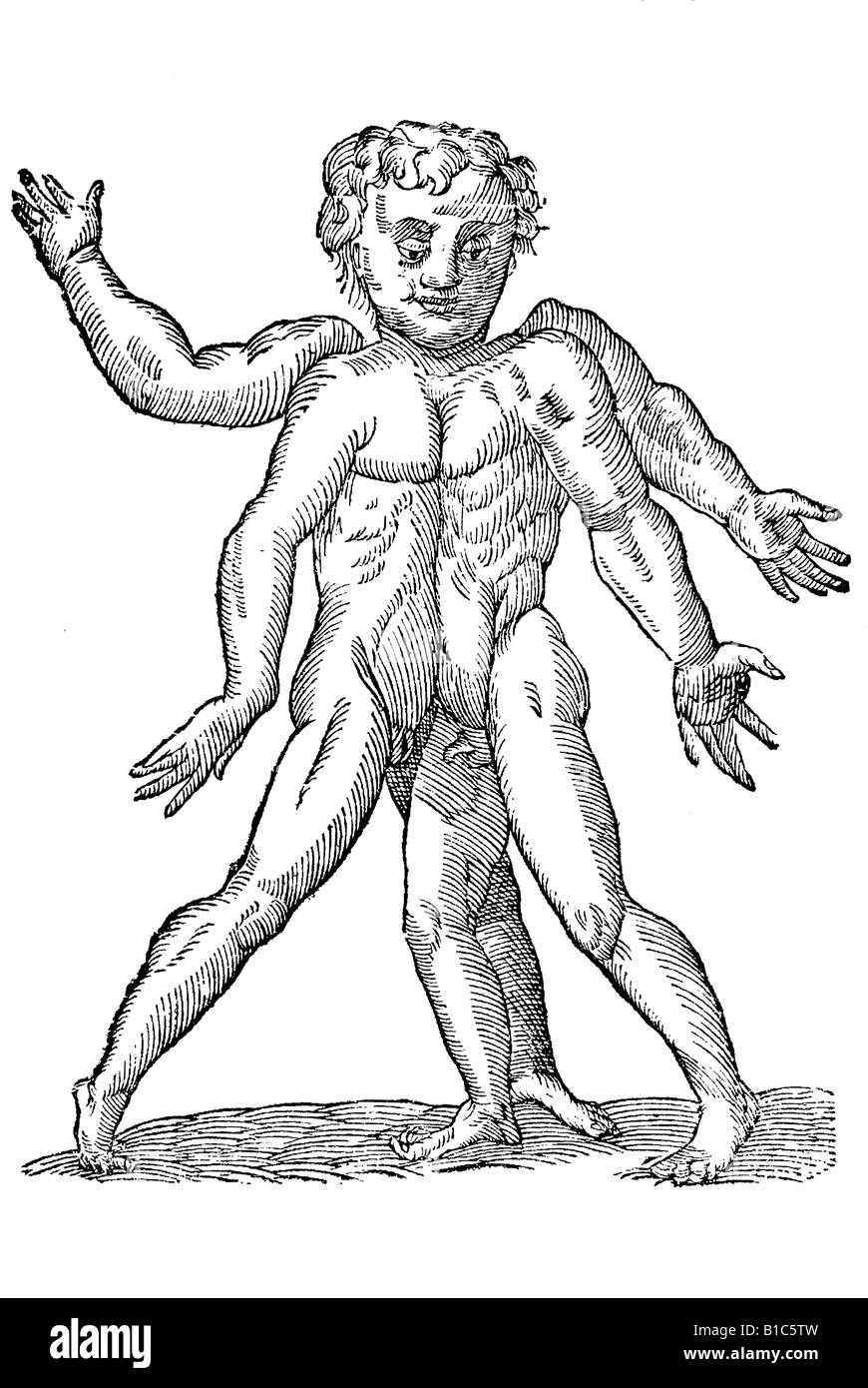 Monstrum hermaphroditicum quatuor brachijs & totidem cruribus, Aldrovandi, 1642, secolo XVII, Rinascimento, Europa Foto Stock