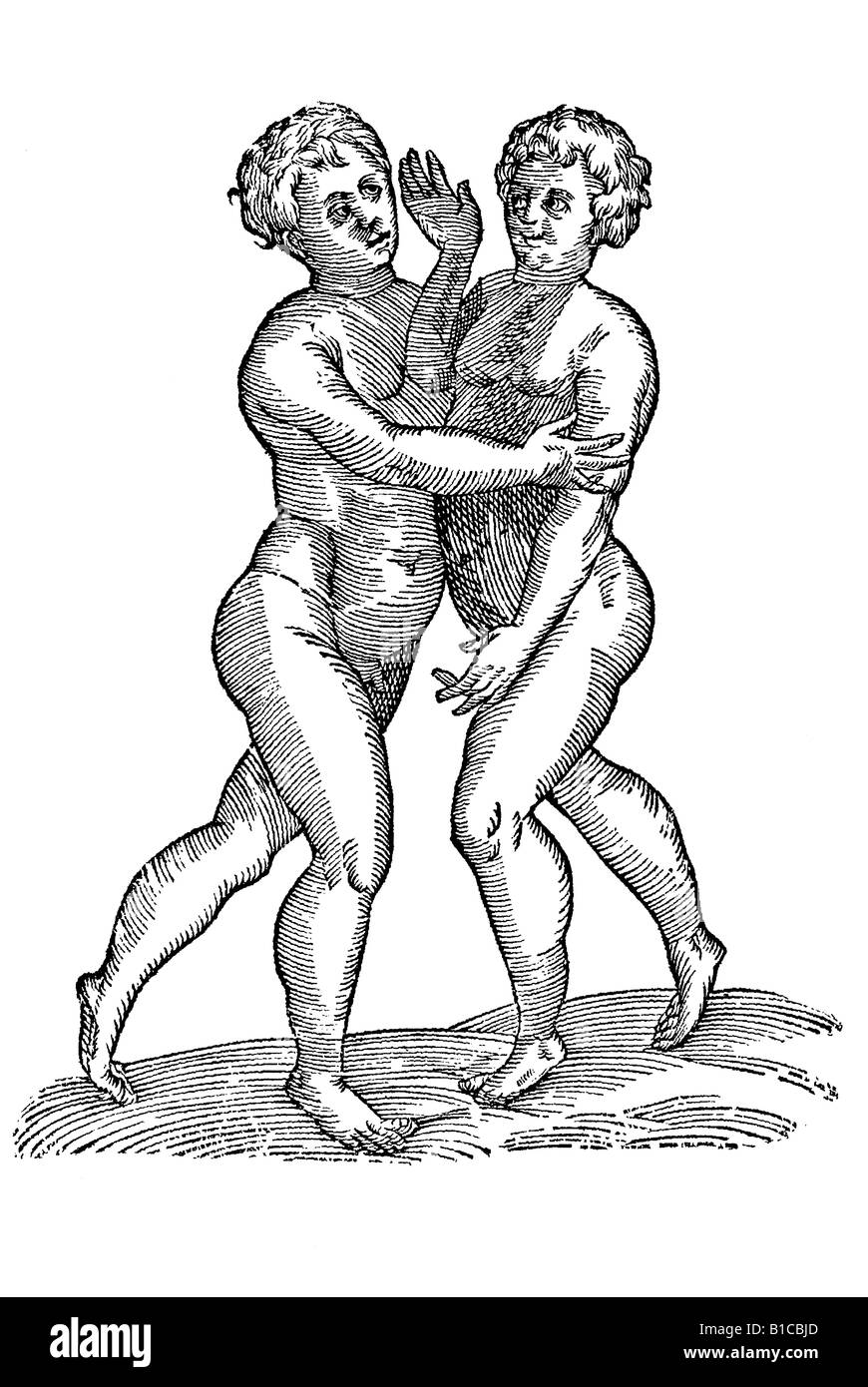 Gemelli connexi pectoribus, Aldrovandi 1642 xvii secolo Europa del Rinascimento Foto Stock