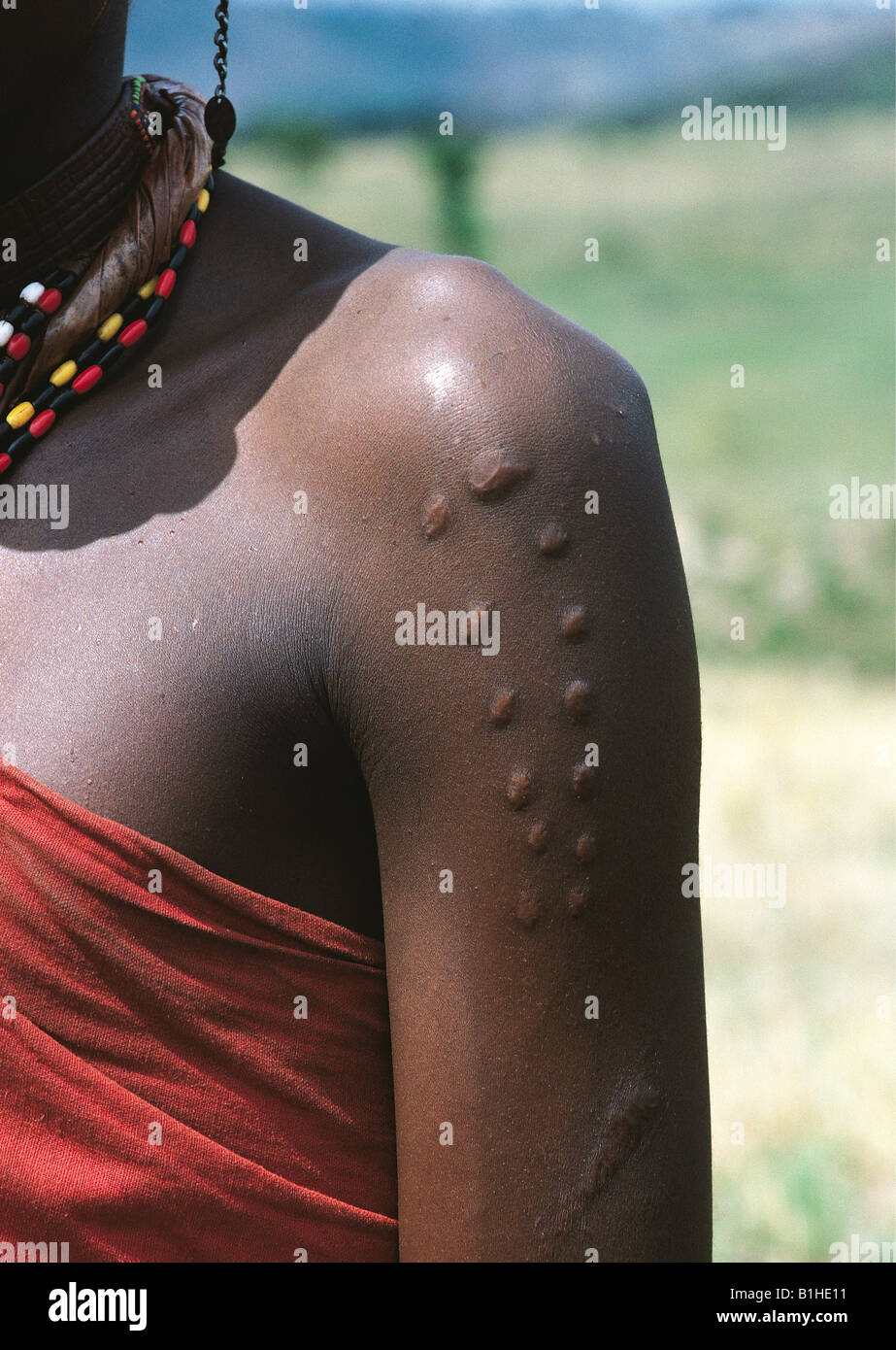 Maasai moran warriors dettaglio decorativo di cicatrice corpo cicatrici sul braccio superiore del Kenya Africa orientale Foto Stock