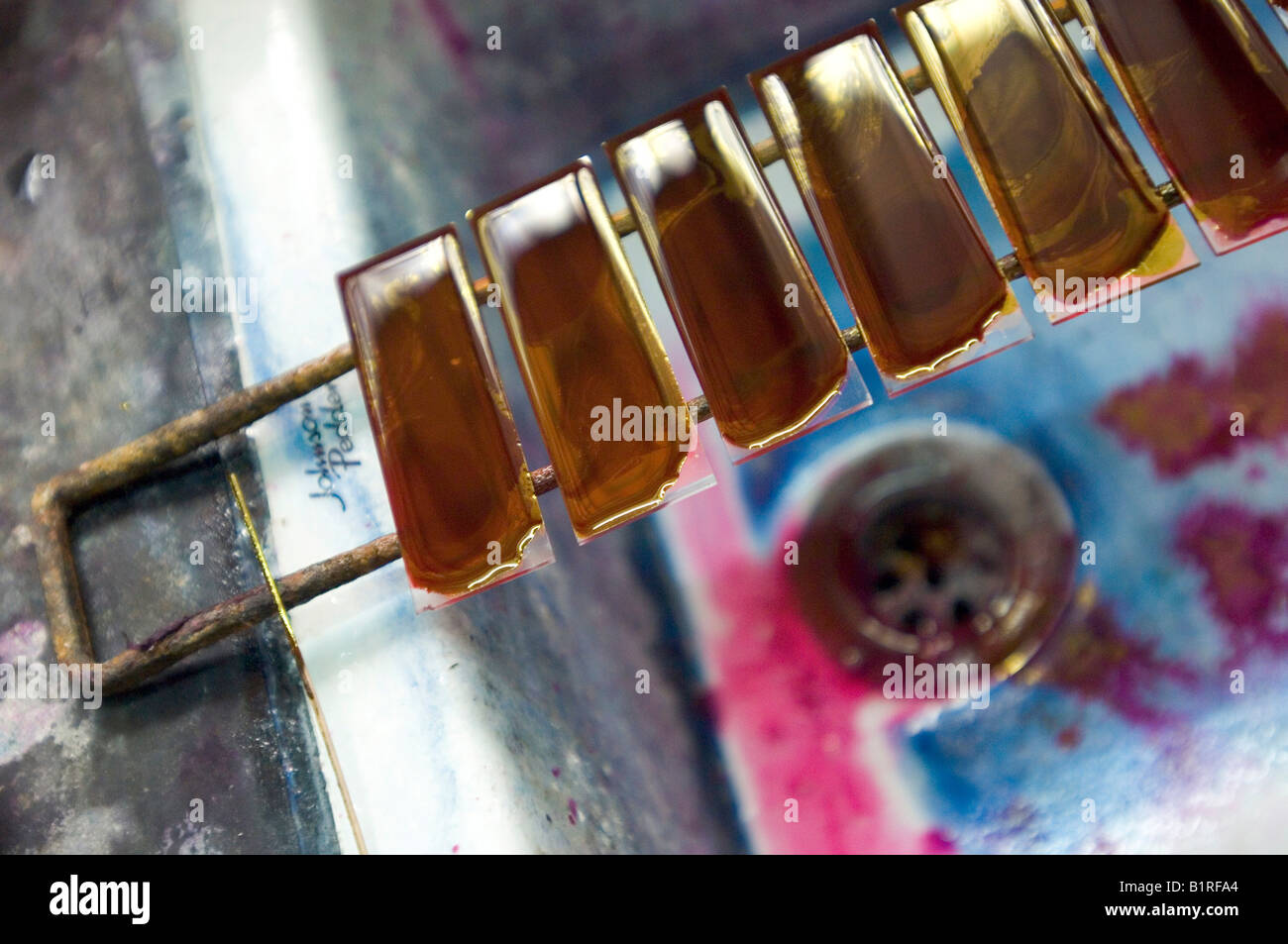 Eosina-fuxin test, test di sputo e i batteri responsabili della tubercolosi, quella di Howrah, Hooghly, West Bengal, India Foto Stock