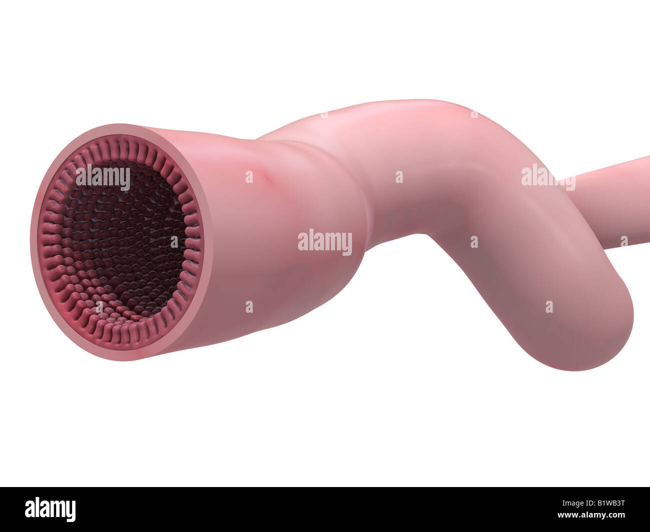 Il piccolo intestino tagliare Foto Stock