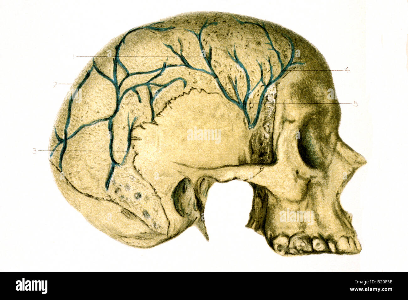 Immagine che mostra il cranio con DIPLOIC VIENS mostrato Foto Stock